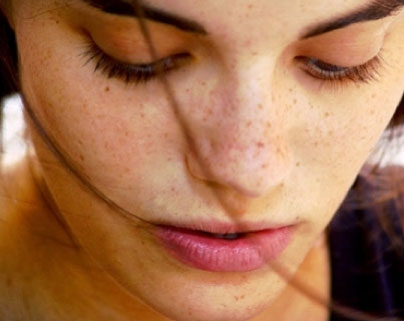 freckles.jpg